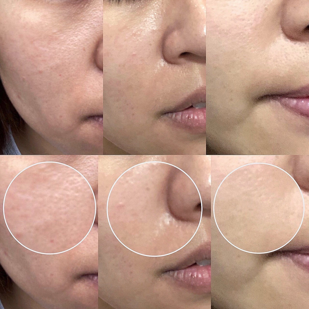 (CÍAO日喬恩) 極光玻尿酸膠囊Skin Hydrating Supplement