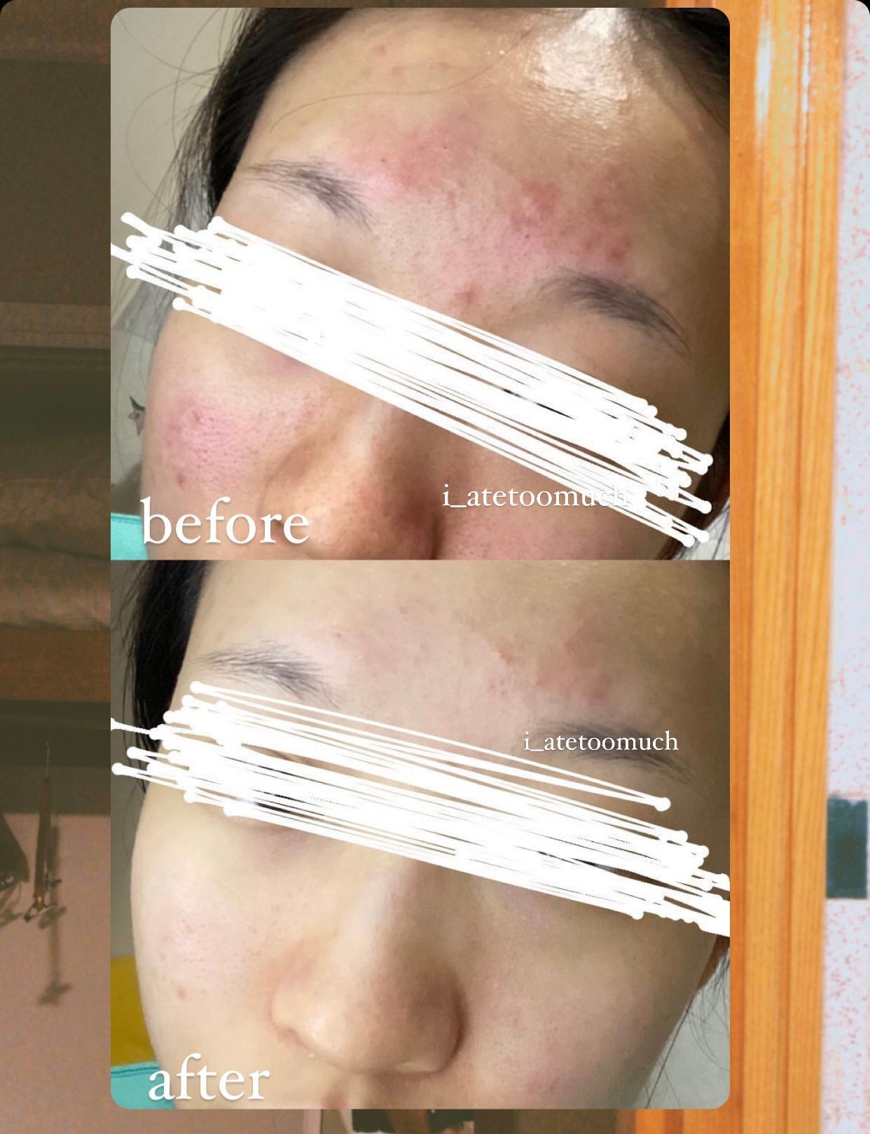 Pharmadex Instant Soothing Mask 退紅鎮靜修復面膜